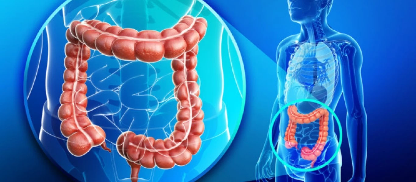 Κοιλιοκάκη: Πότε πρέπει να σταματήσετε την κατανάλωση γλουτένης